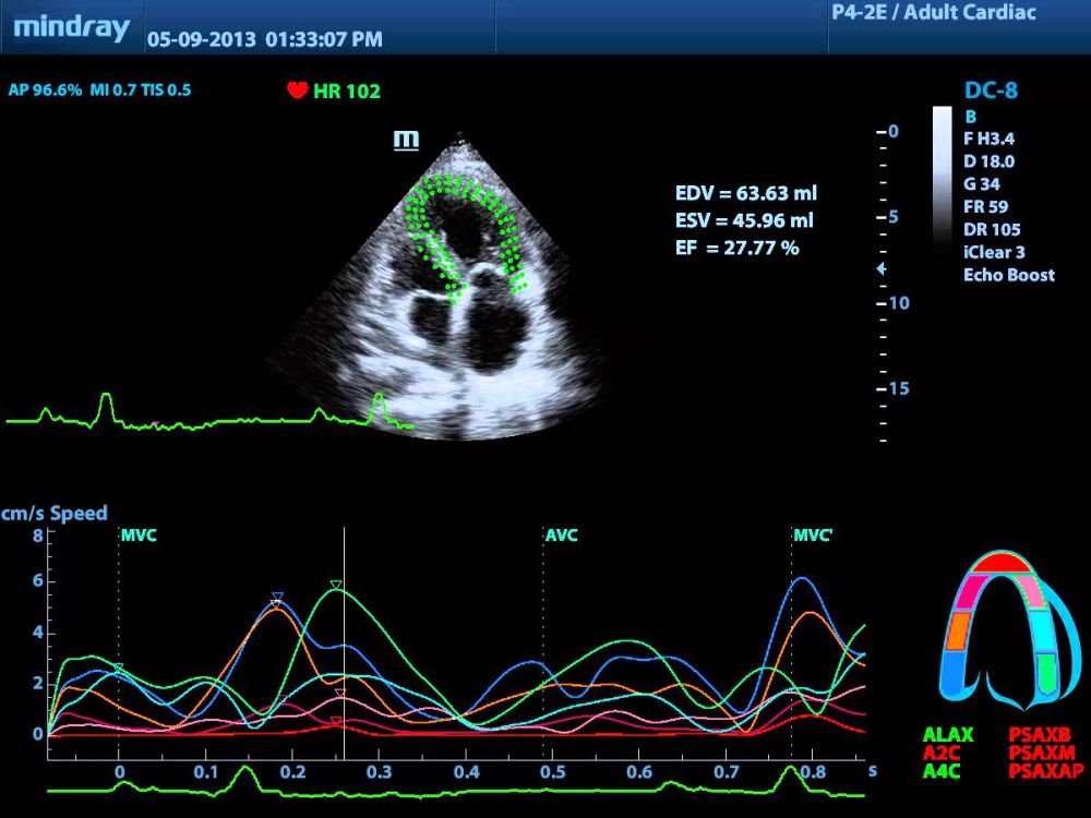 Экспертные функции оценки при кардиологических исследованиях