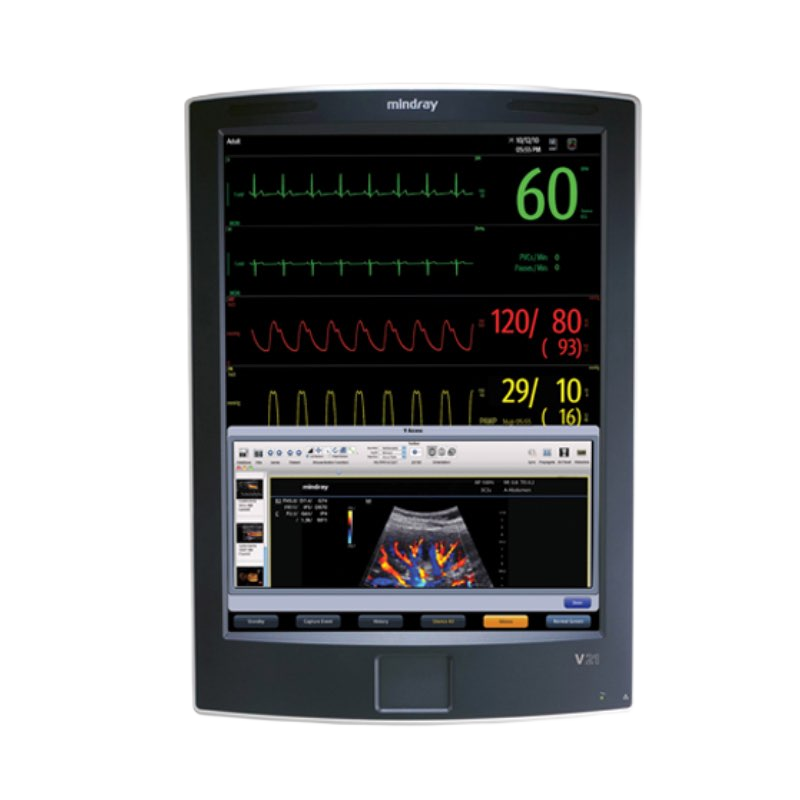 Монитор пациента Mindray V21
