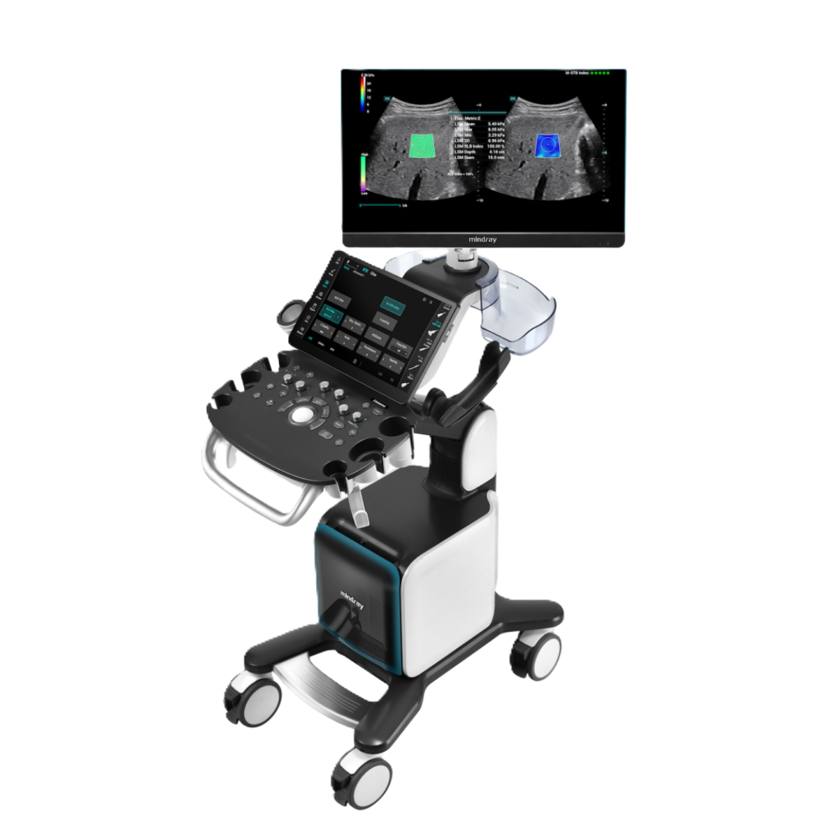 УЗИ аппарат Mindray Consona N9