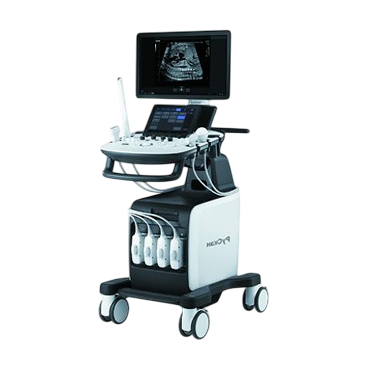 УЗИ аппарат РуСкан 65М