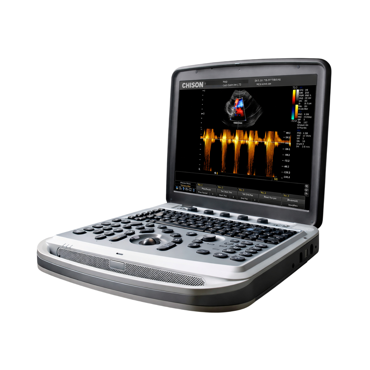 УЗИ аппарат Chison SonoTouch 80 (SonoBook 8)