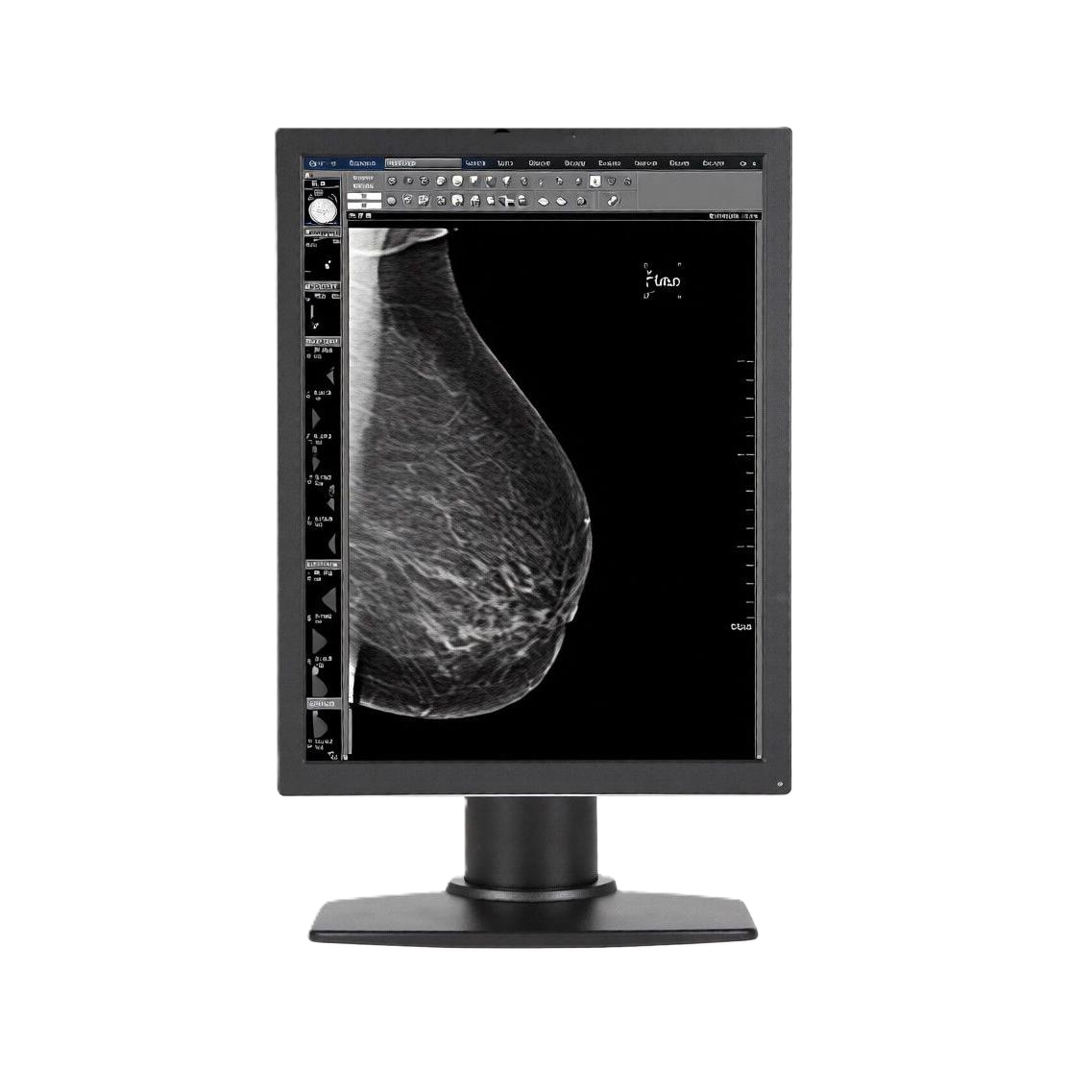 Медицинский монитор Beacon G52S+