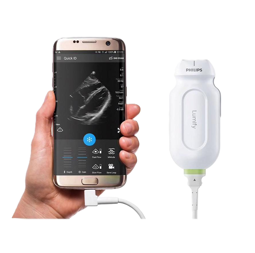 Мобильная ультразвуковая система Philips Lumify