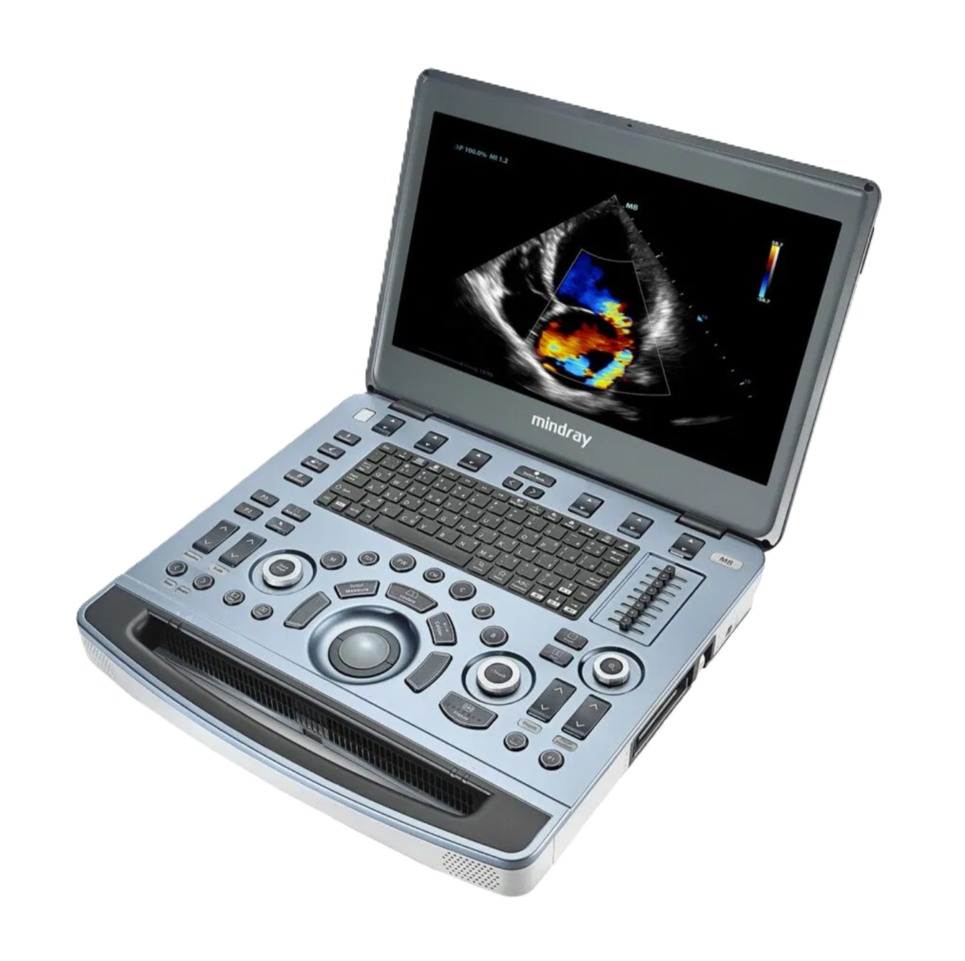 УЗИ аппарат Mindray M8 портативный