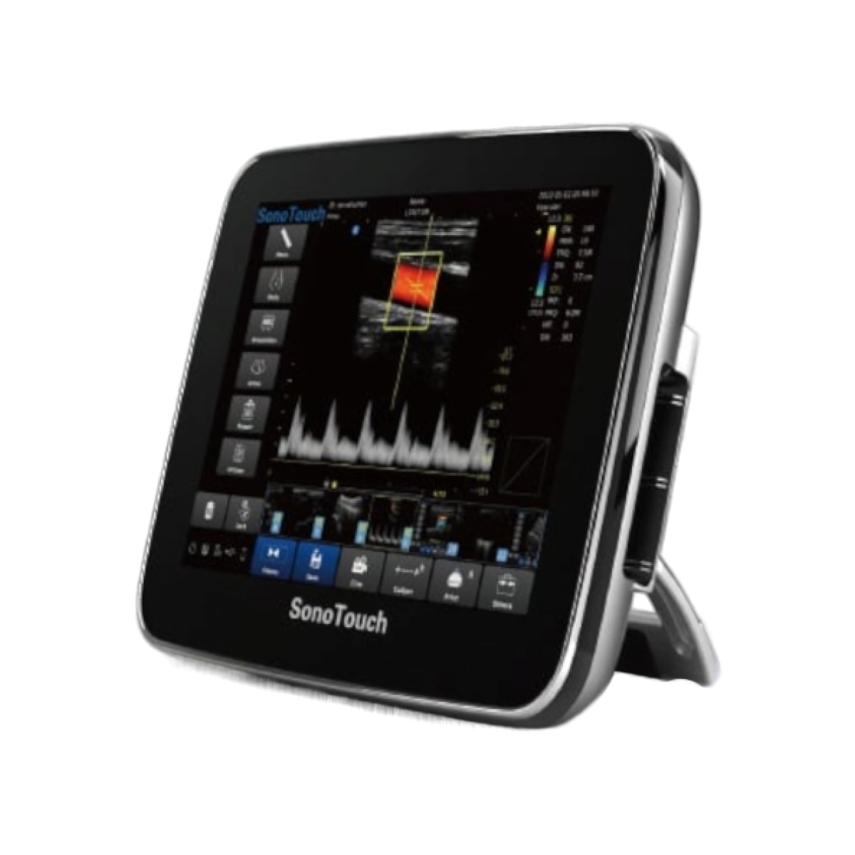 УЗИ аппарат CHISON SonoTouch 30 (ECO 3)