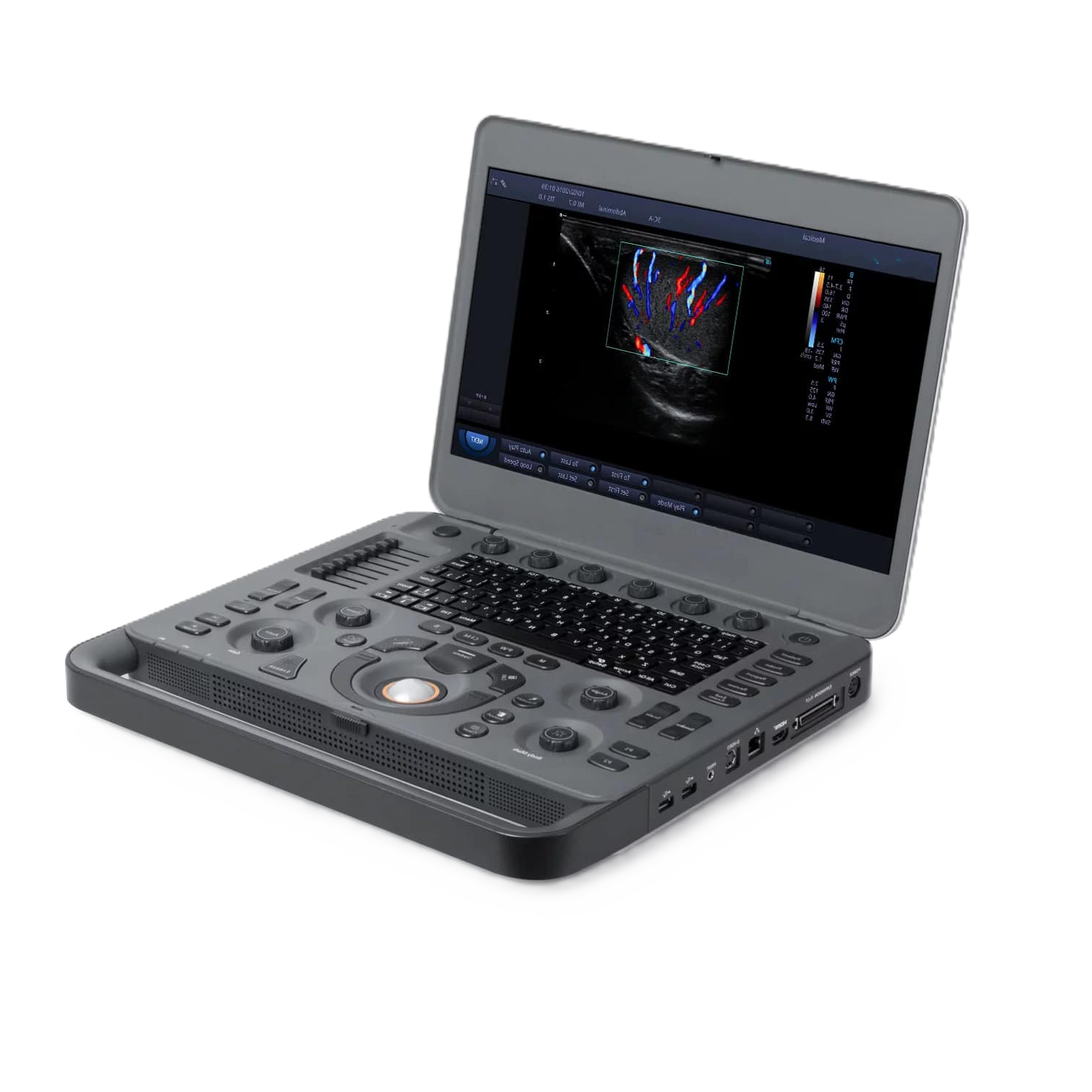 Ультразвуковой аппарат SonoScape S2N Vet