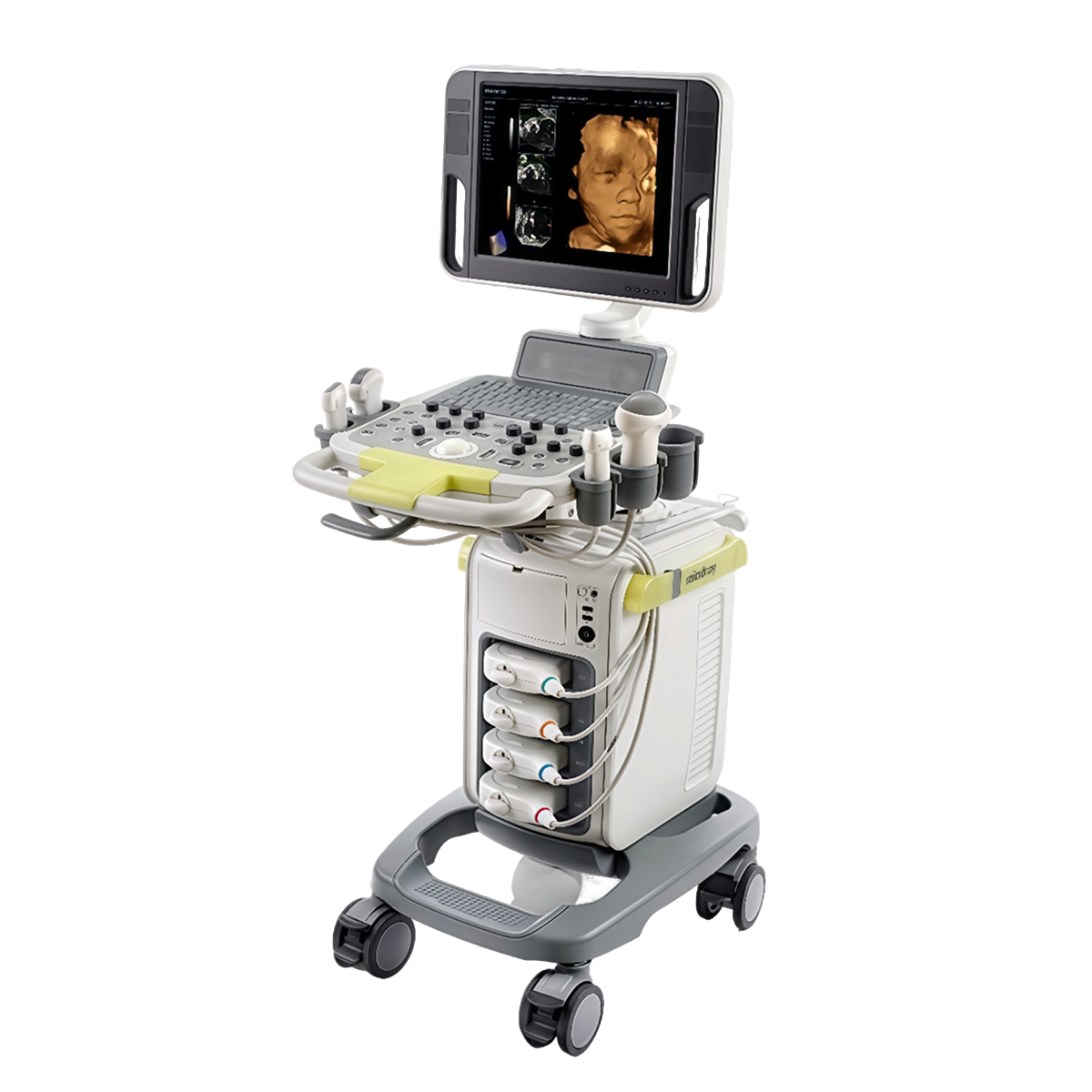 УЗИ аппарат Mindray DC-N3