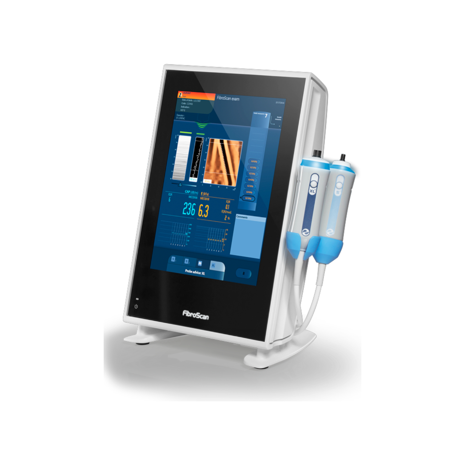 УЗИ аппарат Fibroscan 530 Compact