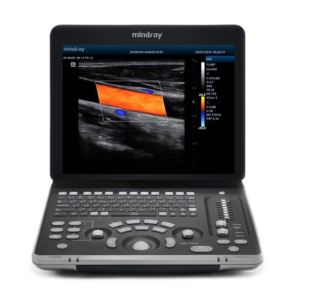 УЗИ сканер Mindray Z60 Exp