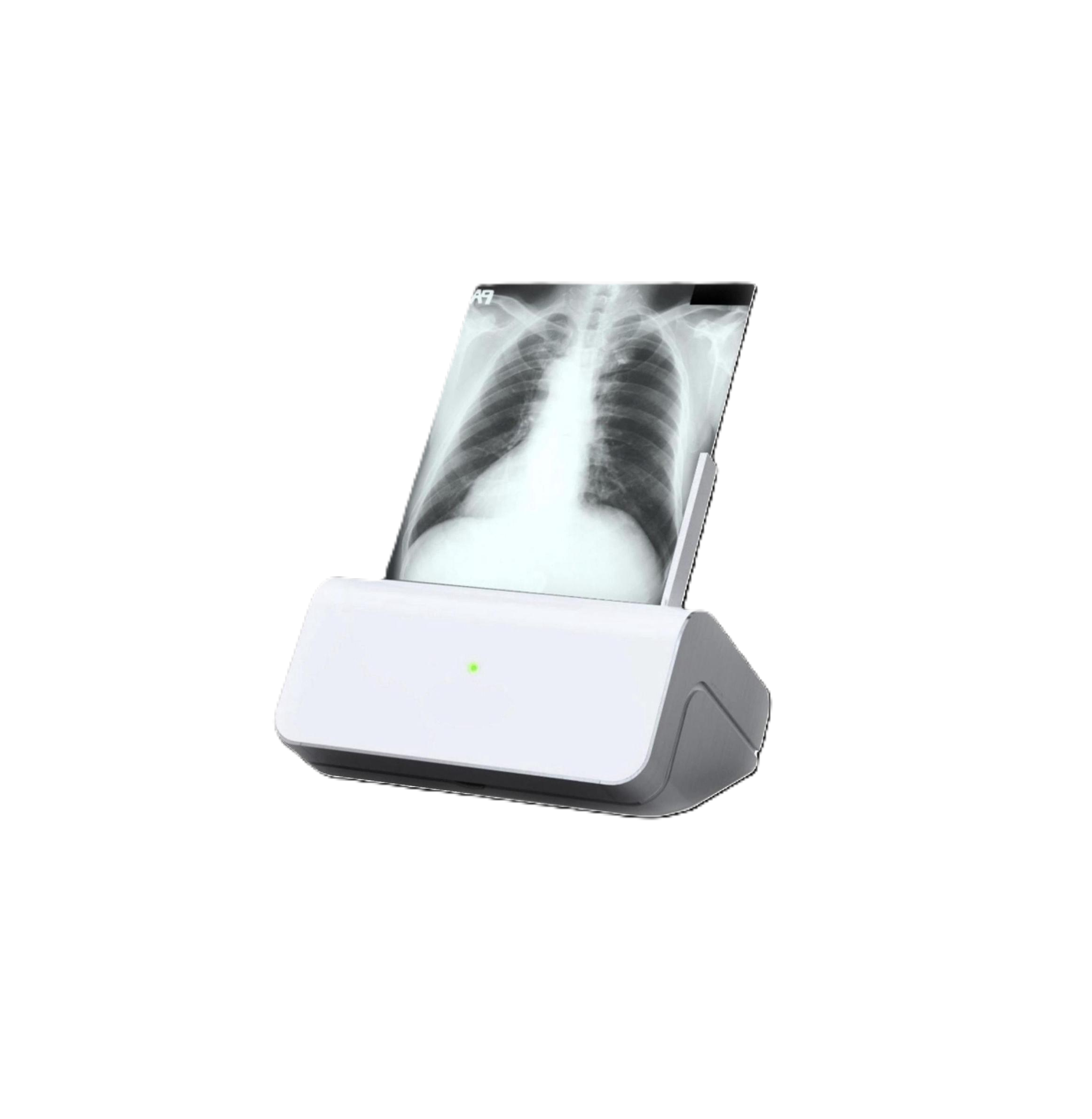 Оцифровщики рентгеновских снимков