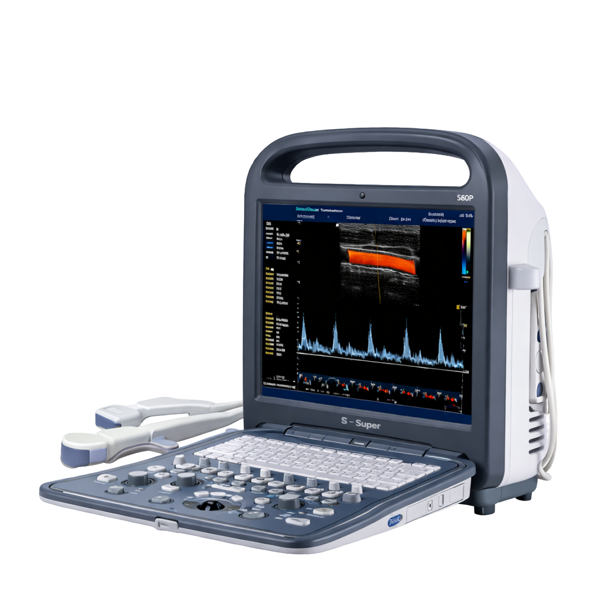 Ультразвуковой аппарат SonoScape S2