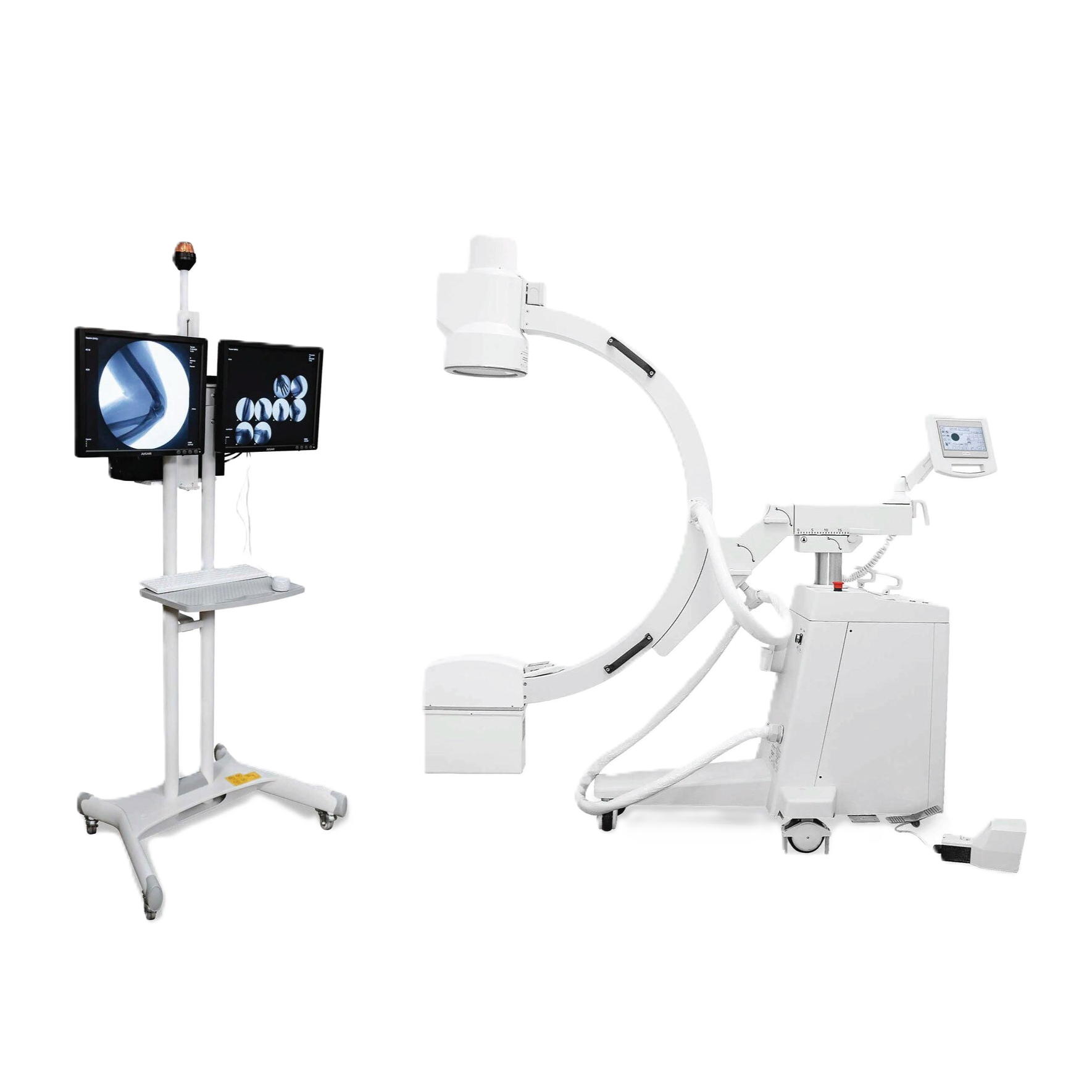 Аппарат рентгено­хирургический передвижной АРХП‑«АМИКО» 8 кВт с цифровым УРИ