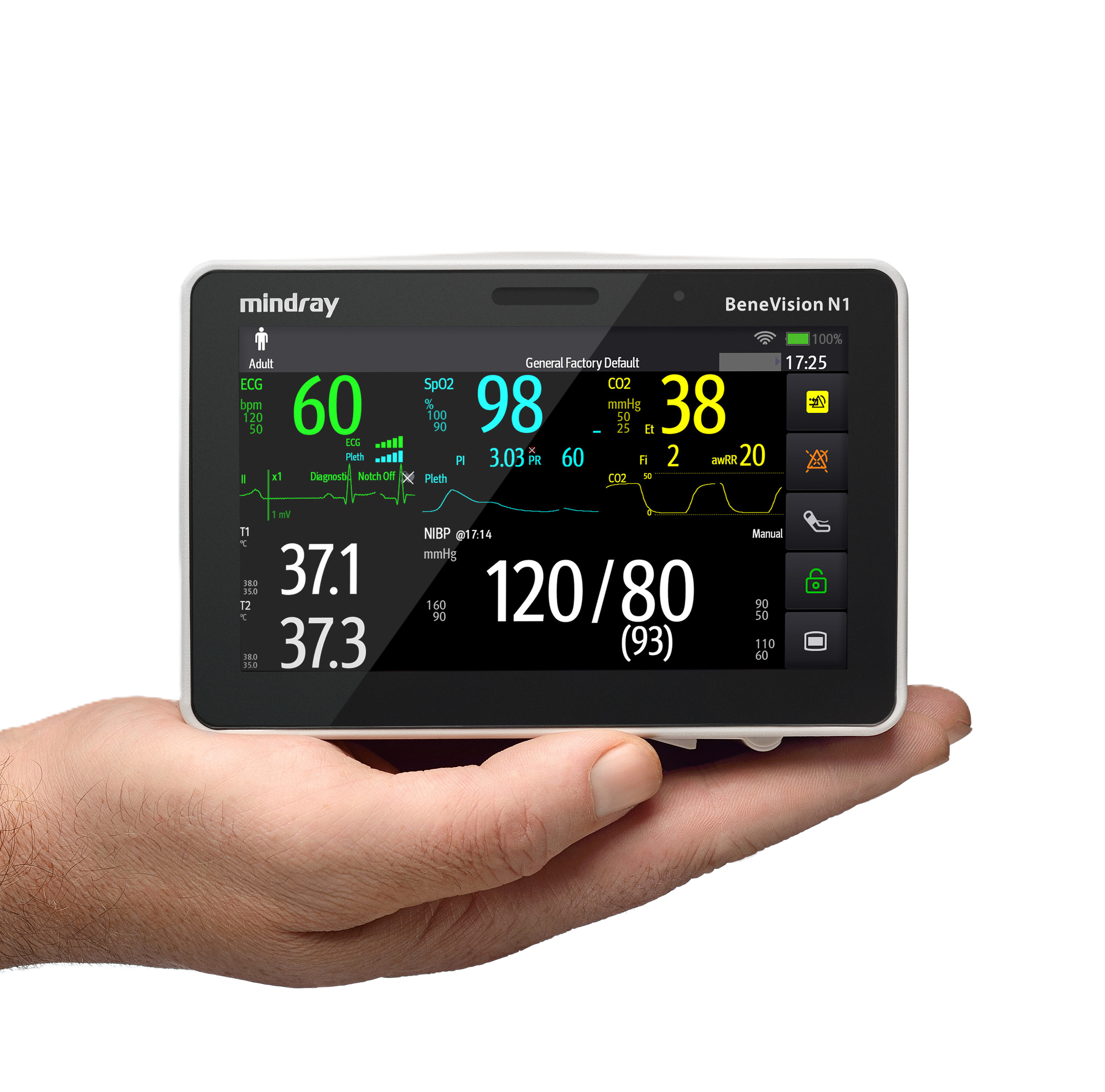 Монитор пациента Mindray BeneVision N1