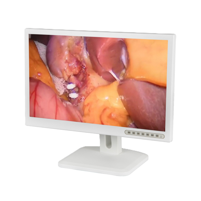 Монитор эндоскопический ОПТИMED 27"