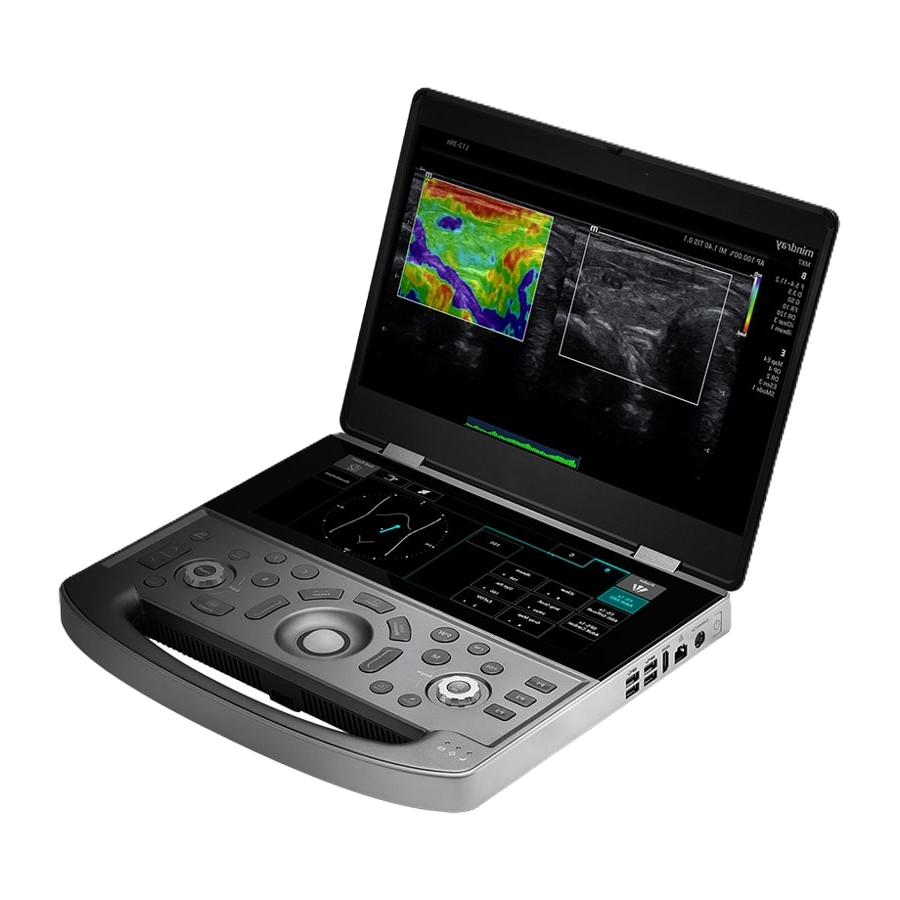 Портативный УЗИ аппарат Mindray MX8 Exp