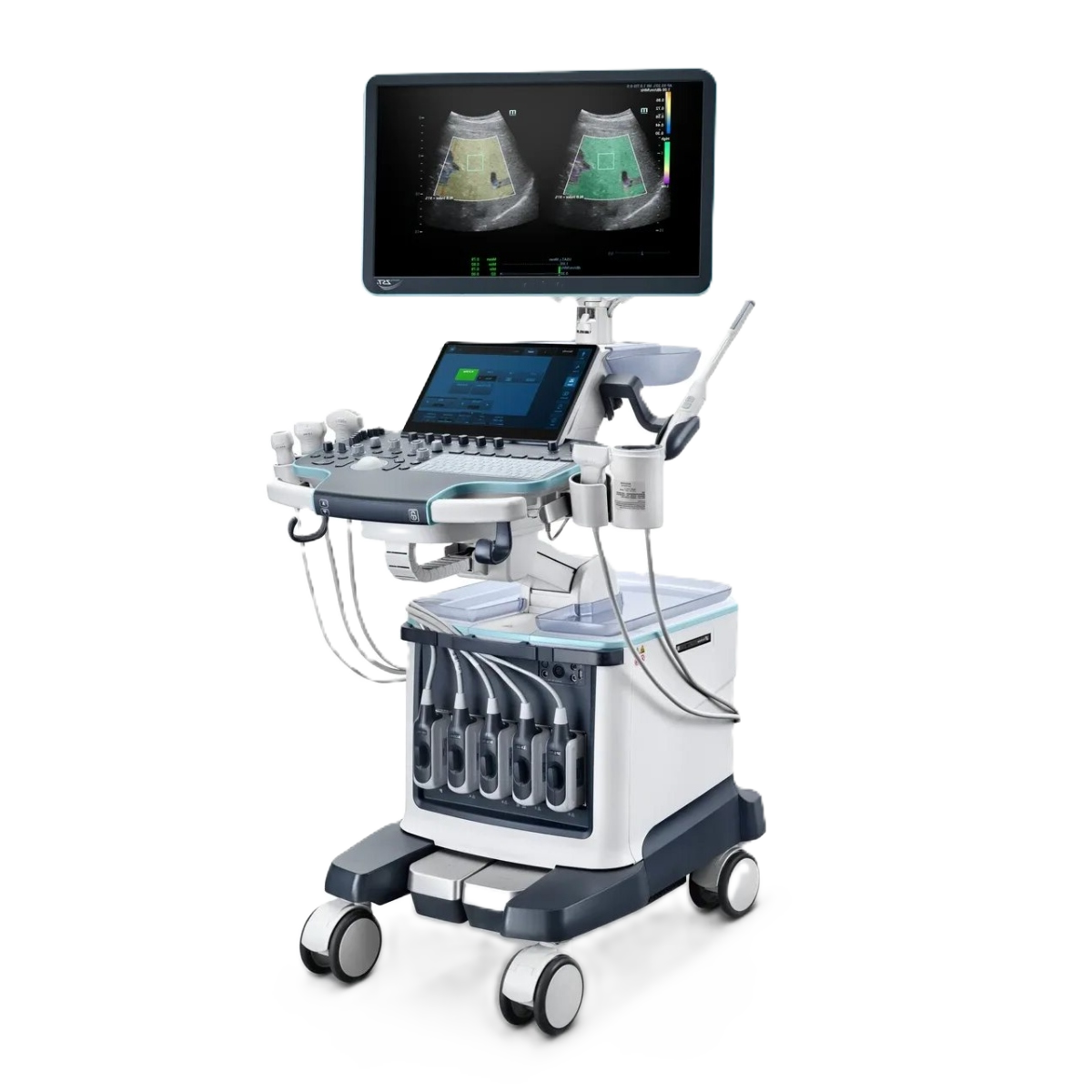 УЗИ аппарат Mindray Resona R9