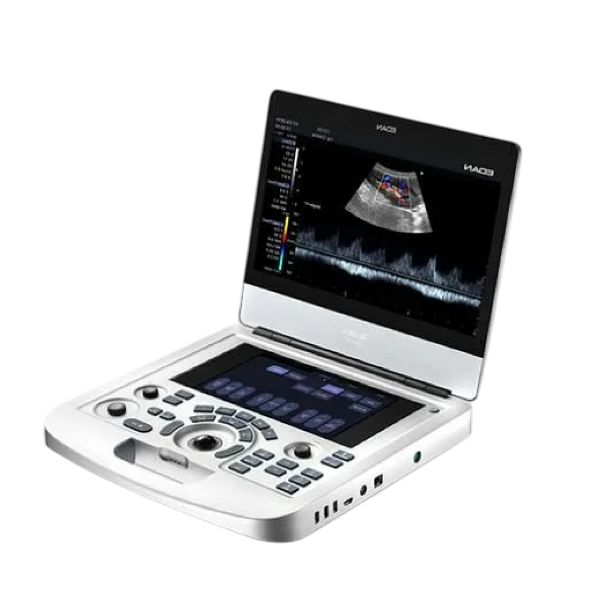 УЗИ аппарат Edan Acclarix AX3 для ветеринарии