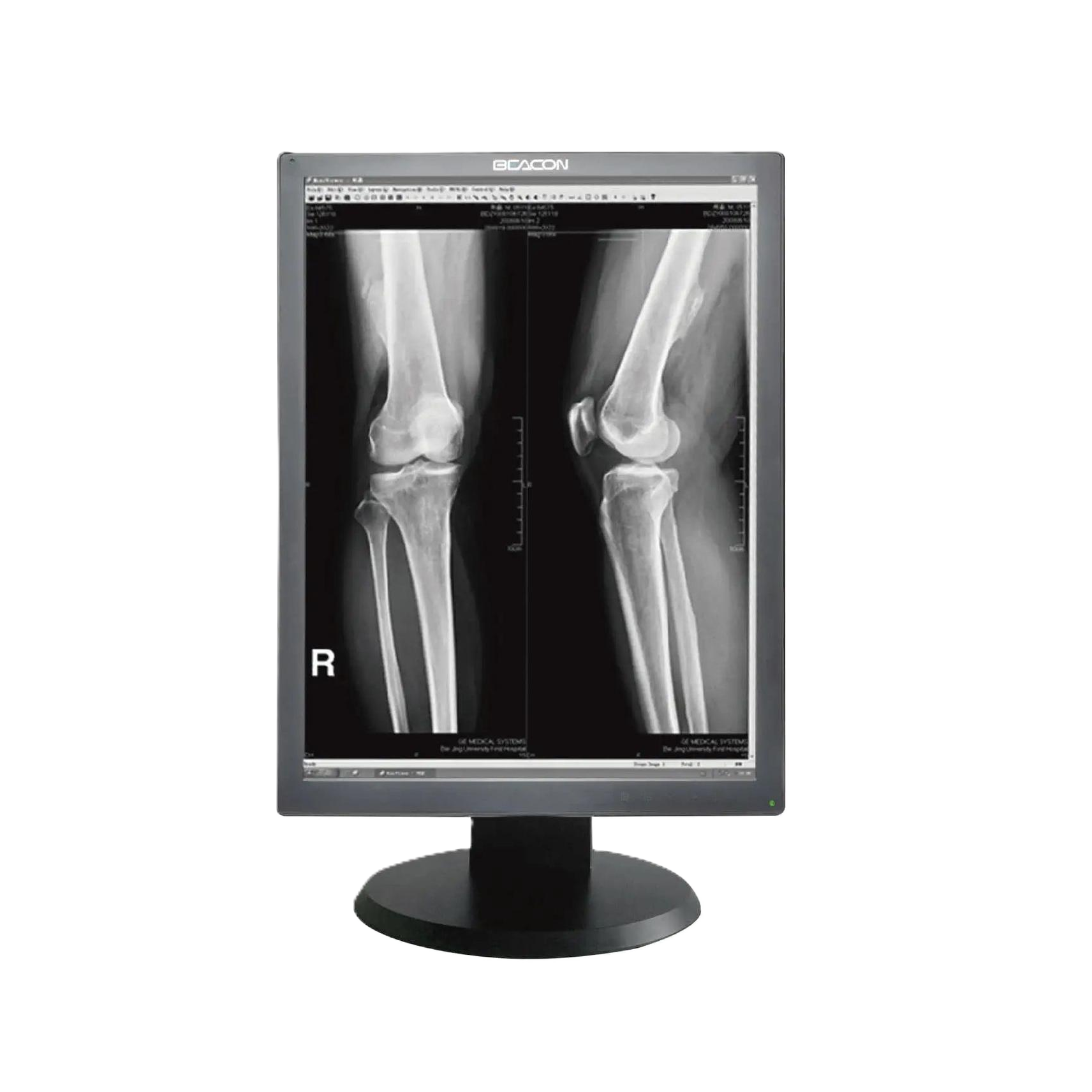 Медицинский монитор Beacon G23S+