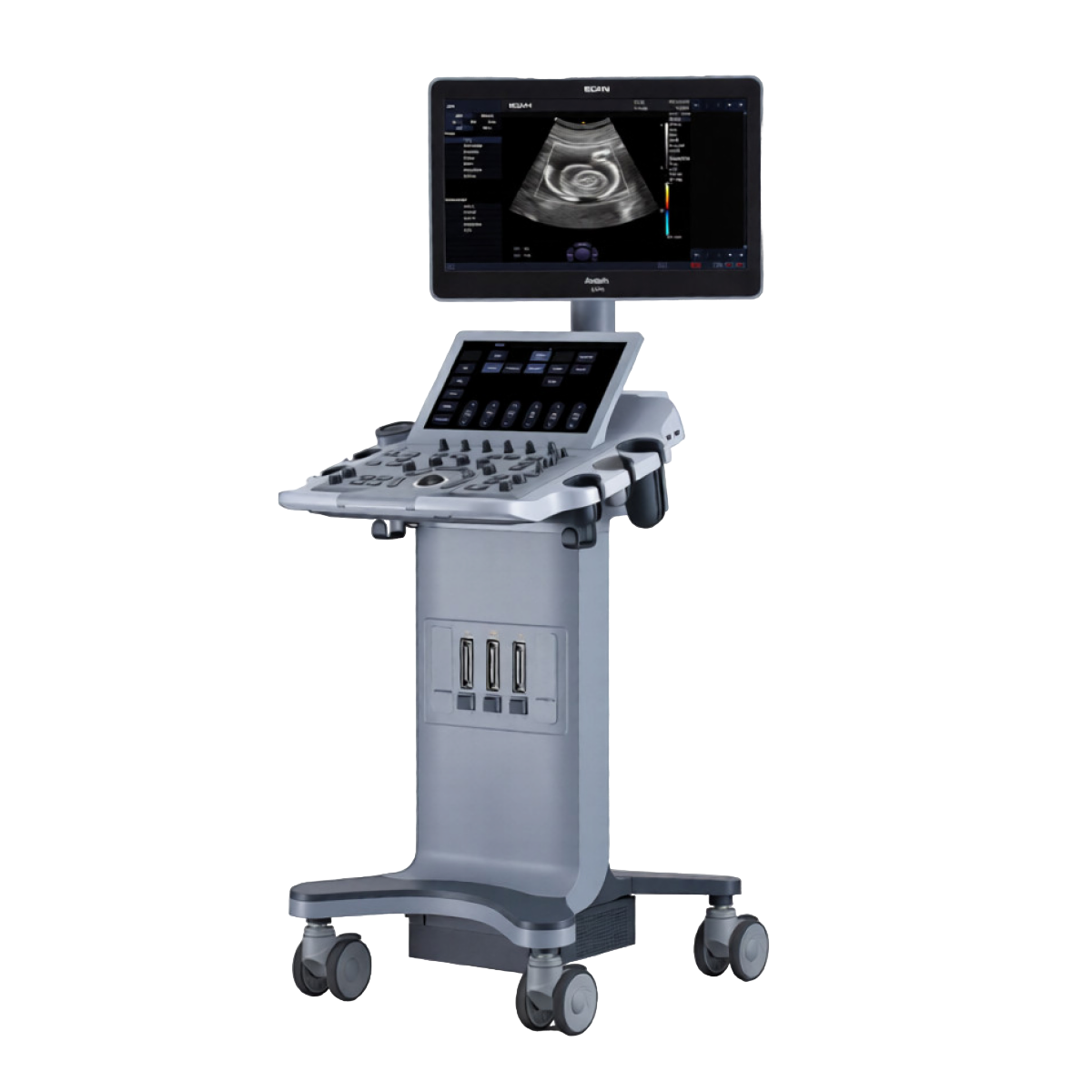 УЗИ аппарат Edan Acclarix LX25